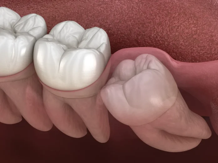 Oral and Maxillofacial Surgery