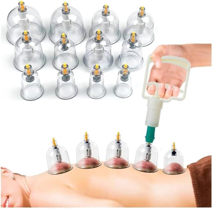 Hijama in Dubai