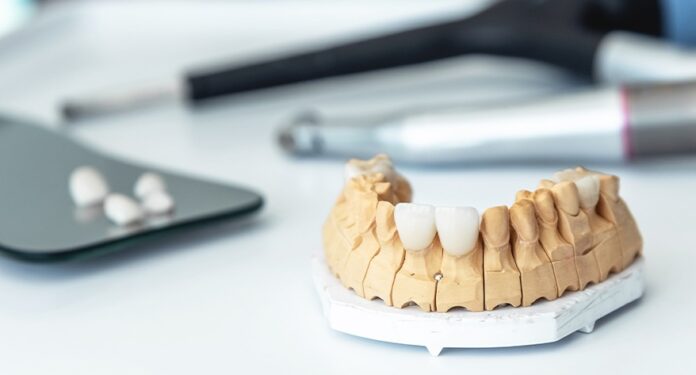 Rebuilding Smiles: The Importance of Restorative Dentistry in Anthem