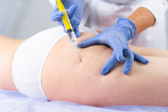 Body Filler Dubai