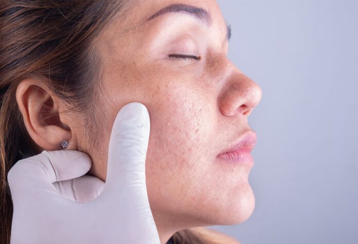 Dermatologist in Dubai