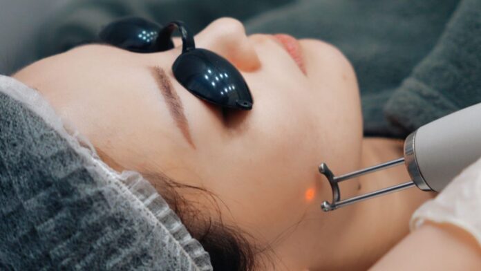 Pico Laser Treatment in Dubai