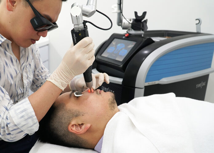 Pico Laser Treatment