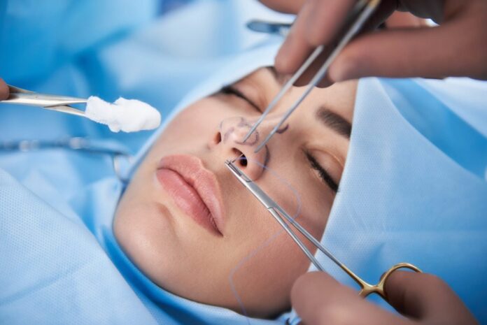 Who Is an Ideal Candidate for Rhinoplasty?