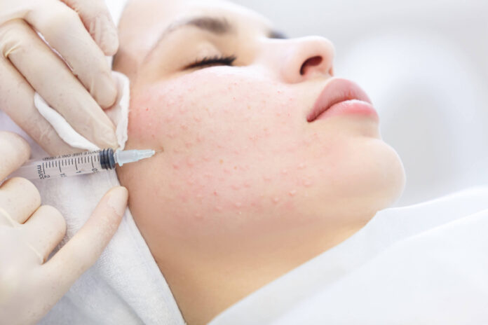 Skin Booster Injection in Dubai