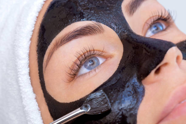 Laser Carbon Peel in Dubai LASER CARBON PEEL
