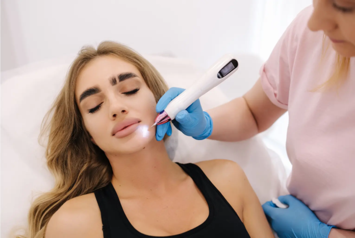 Skin Tag Removal in Dubai.
