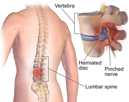 lower-back-pain One powerful option for managing severe pain is Aspadol 150mg, a high-strength formulation of Tapentadol.