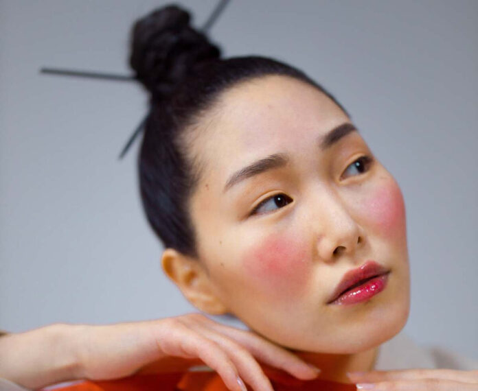 Rosacea Treatment