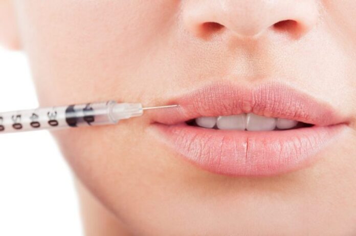 What Are the Different Types of Lip Fillers?